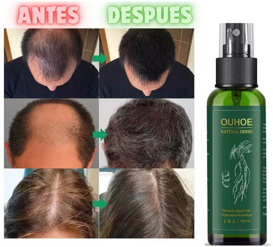 OUHOE - CRECIMIENTO DE CABELLO